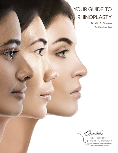 Rhinoplasty Surgery eBook by Quatela Center for Plastic Surgery