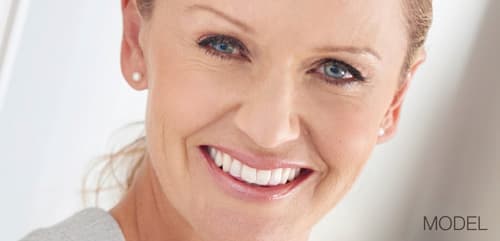 Facelift model smiling