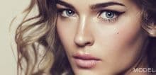Rhinoplasty model looking over her shoulder