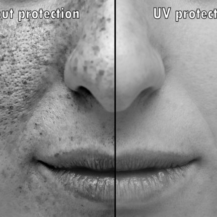 Sun damage on face