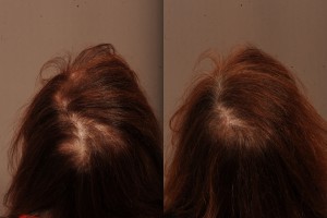 HairMedica B&A