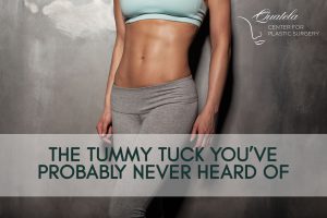 The tummy tuck you've probably never heard of