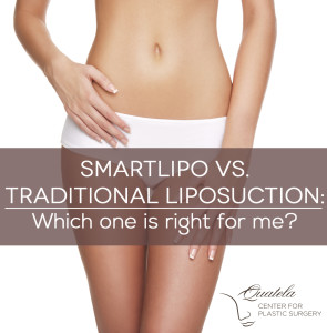 smartlipo vs lipo pin