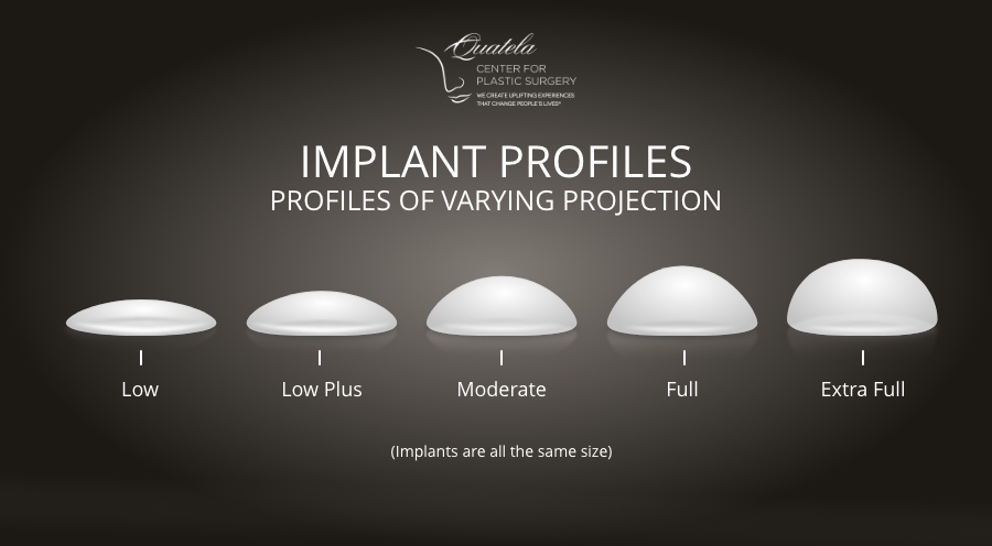 Implant Profile Chart