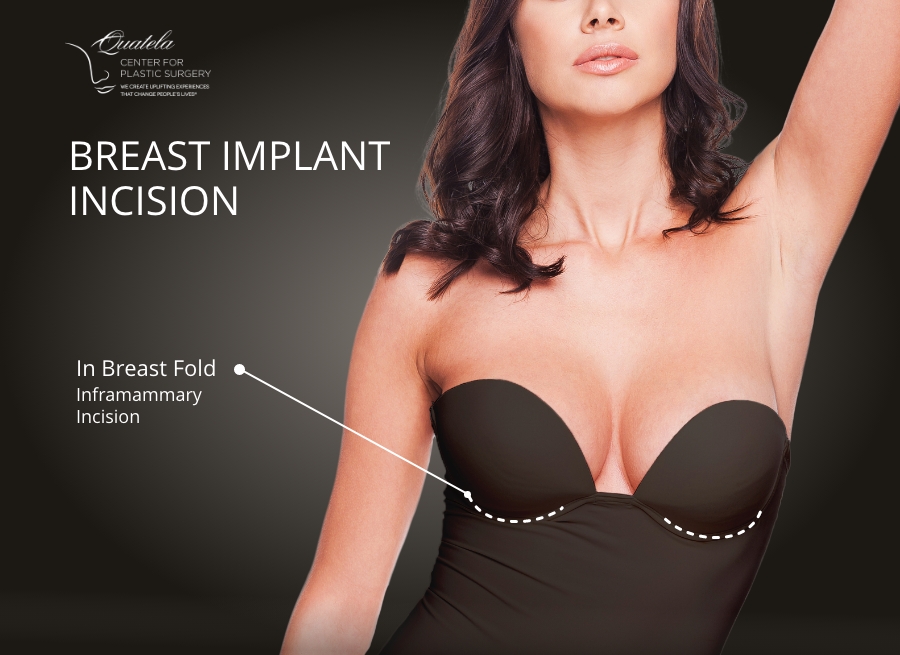 breast incisions