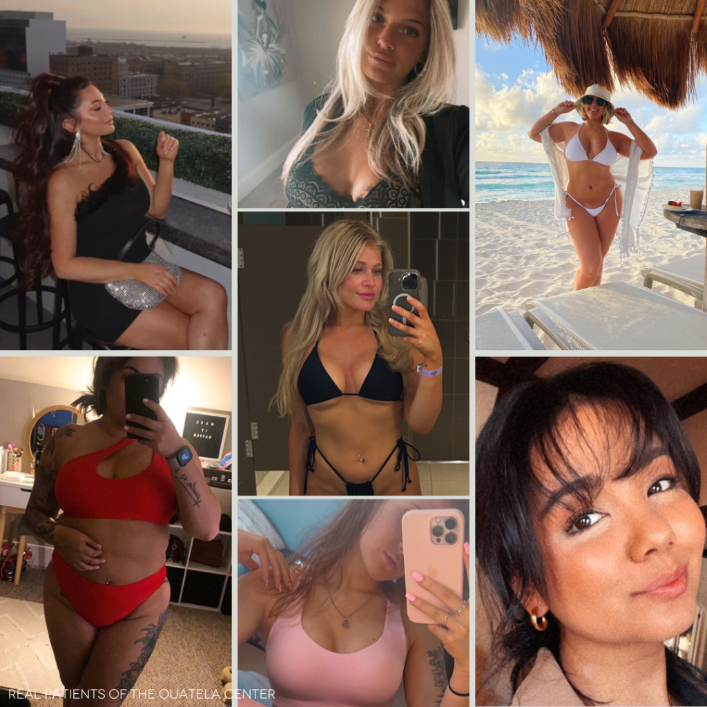collage of patient selfies for face and body