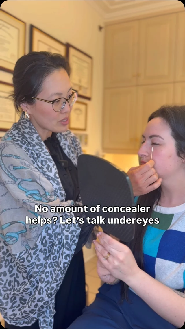 “I’ve tried every concealer, but nothing helps…” 
That’s what we hear all the time - and it’s not your fault. Undereye hollows and discoloration are often genetic, and topical products can only go so far.
In this consultation, Dr. Lee explains the real reasons behind persistent under eye concerns (like fat pad shifting, muscle laxity, and vascular discoloration) and what can actually help:
✔️ Strategic filler for hollowing
✔️ Topical tranexamic acid for discoloration
✔️ Long-term options like lower blepharoplasty
Sometimes just understanding what’s going on under the skin makes all the difference. 
✨ Ready to finally feel good about your under eyes? Comment “DETAILS” to get started!