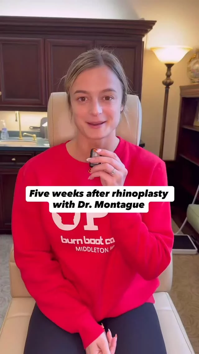 “It was the best decision that I made. I’m so happy I did it.”

Eva’s rhinoplasty journey with Dr. Montague delivered more than she expected - better breathing, transformed sleep quality, and confidence that goes beyond the mirror. 

Comment or DM “details” to learn more about personalized rhinoplasty at the Quatela Center.