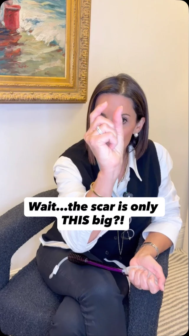 Just 3 centimeters. That’s it. 🤏

With the preservation breast augmentation technique, Dr. Amalfi creates a tiny incision - often just 3 cm or smaller - using specialized tools and next-gen ergonomic implants. The result? A natural look, minimal scarring, and a smooth, safe placement process.

Comment or DM “PRESERVATION” to learn more about this procedure!