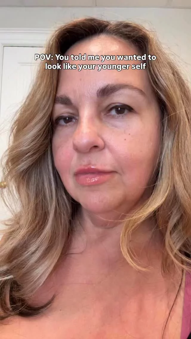 From Massachusetts to NY for a reason

She was DONE with her turkey neck and ready for real, lasting results. Dr. Montague delivered with: 
✔️ Deep Plane Facelift 
✔️ Temporal Lift 
✔️ Upper Eyelid Lift 

4 months post-op and she’s absolutely glowing! The right surgeon is worth the trip. 

Comment “DETAILS” for more info!