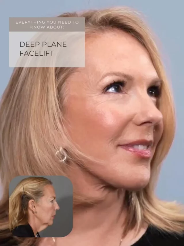 Let your reflection match how vibrant you feel.

The deep plane facelift is the gold standard for facial rejuvenation—tightening and elevating facial structures together for results that look natural, never tight or pulled. Unlike traditional facelifts that lift muscle and skin separately, this sophisticated technique creates longer-lasting outcomes that truly transform how you look and feel.

Focusing on the lower face and neck, it softens jowls, defines the jawline, and smooths laugh lines.

For a truly harmonious result, it’s often paired with subtle enhancements like a brow lift, eyelid surgery, fat transfer, or skin resurfacing. Healing timelines vary based on the procedures combined, and your surgeon will guide you every step of the way.

Ready to look as vibrant as you feel? Comment or DM “UPLIFT” and take the first step.