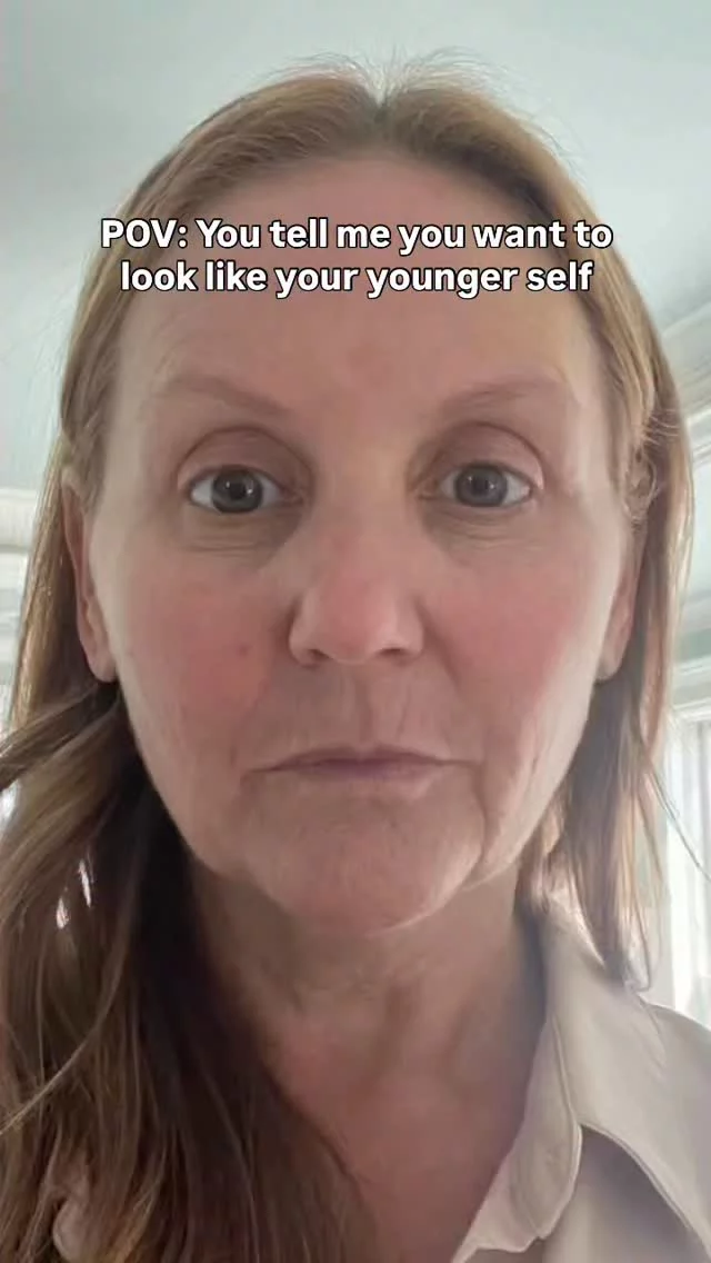 Look like yourself, just younger! ✨

Surgery: Facelift, endoscopic forehead lift, pre jowl chin implant with chinpexy, lip lift and full face resurfacing
Post-Op: 1 year

Surgeon: World-Renowned Double Board-Certified Facial Plastic Surgeon Dr. Vito Quatela

Interested in learning more about facelifts? Comment ‘UPLIFT’ below and we’ll send you a DM!